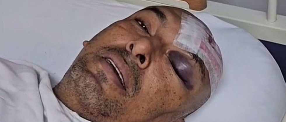 «No puedo caminar»: Omar Angulo continúa delicado de salud y se mantiene postrado en cama