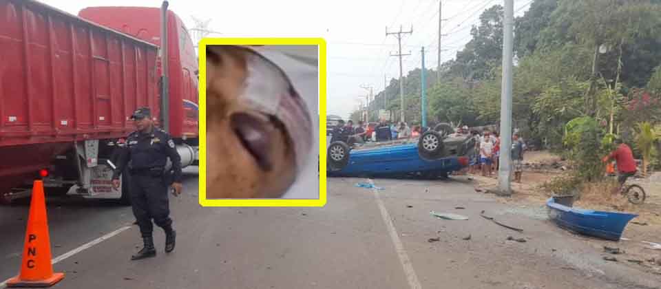 Omar Angulo empeora salud tras sufrir aparatoso accidente