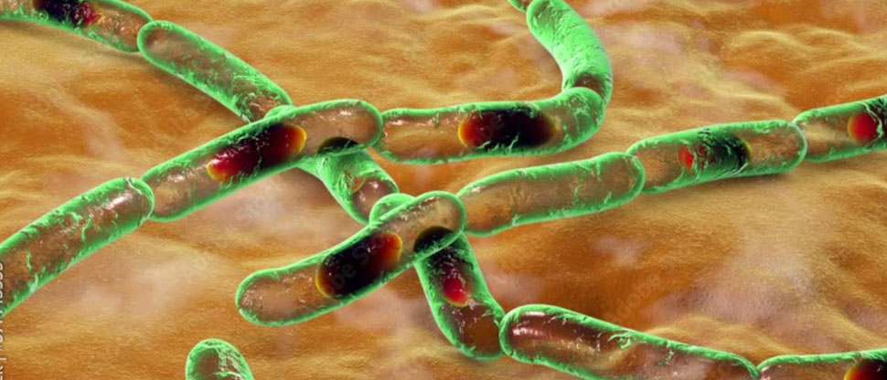 HAITÍ: Ministerio de Salud emite alerta sanitaria por casos de ántrax