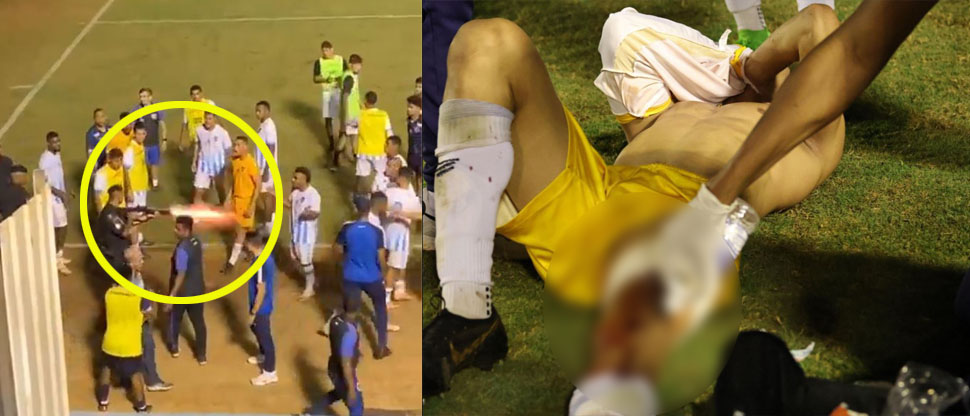 BRASIL: Policía le dispara a un jugador de la segunda división y lo deja lesionado