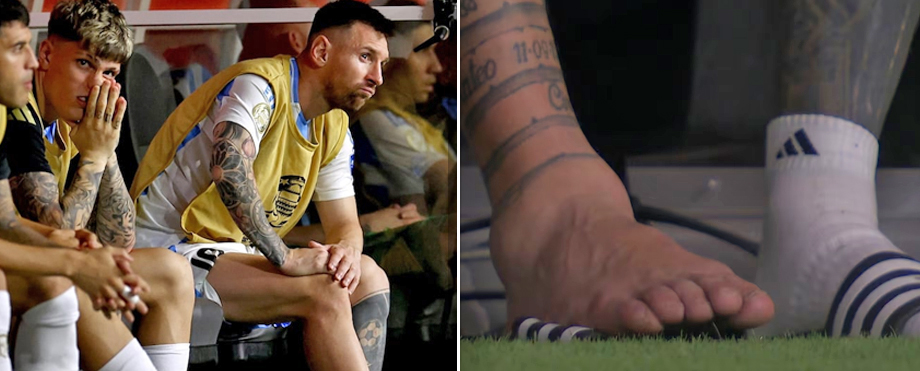 La impresionante imagen del tobillo de Messi que lo obligó a salir por lesión