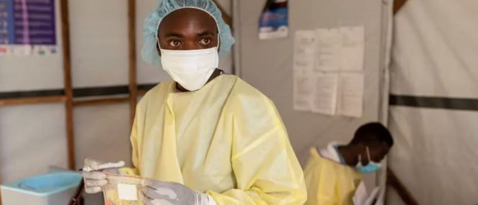 EL CONGO: Autoridades de salud confirman 548 decesos a causa de la viruela del mono