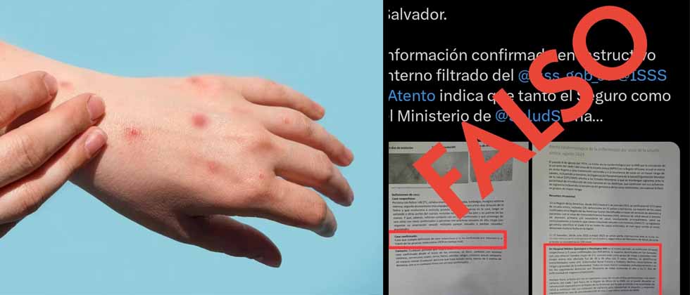 ISSS desmiente casos de viruela del mono en El Salvador