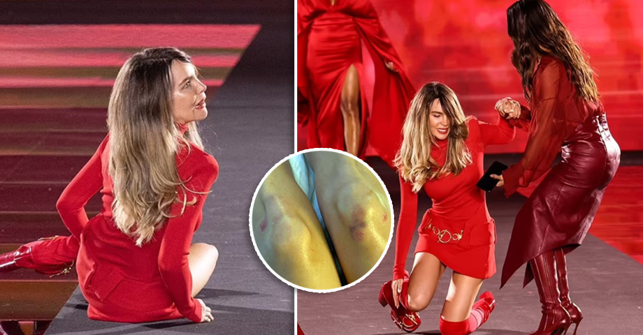 Así quedaron las rodillas de Belinda tras su caída en la pasarela de París