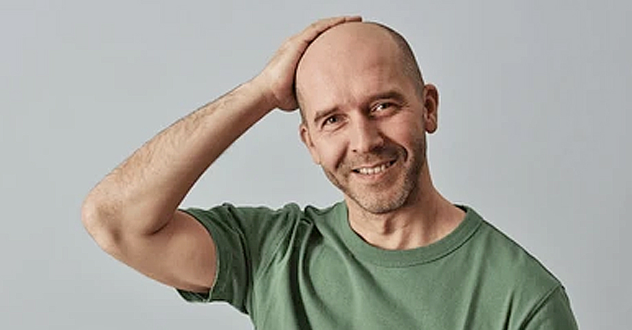 Hoy 7 de octubre se celebra el “Día mundial de los calvos”