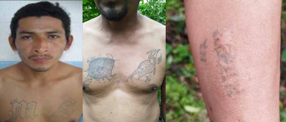 Detienen a MS que intentó borrarse sus tatuajes de delincuente
