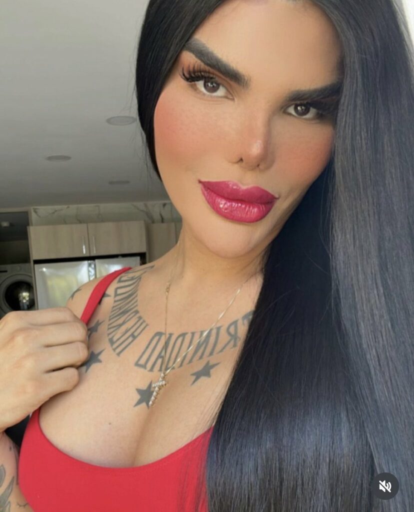 René Valdivieso asegura que siente «aberración y terror» al ver su «parte masculinas»