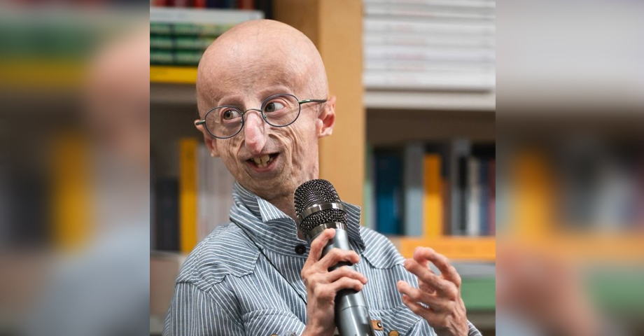Muere Sammy Basso, la persona con envejecimiento prematuro más longeva del mundo