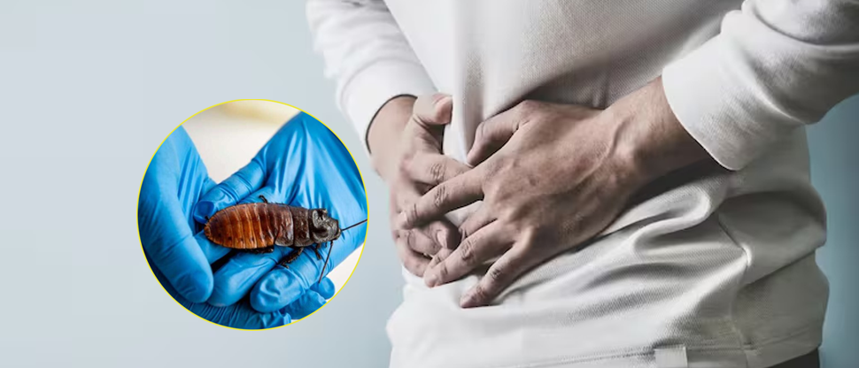 Joven consulta por dolor de estómago y le descubren una cucaracha viva en el intestino