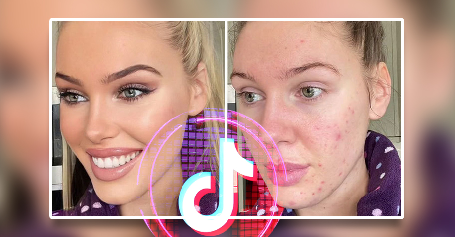 TikTok eliminará los filtros de belleza tras denuncias por salud mental