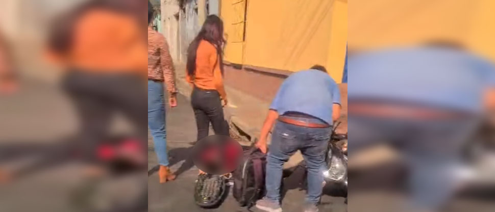 Motociclista termina en el hospital tras accidentarse en Santa Ana