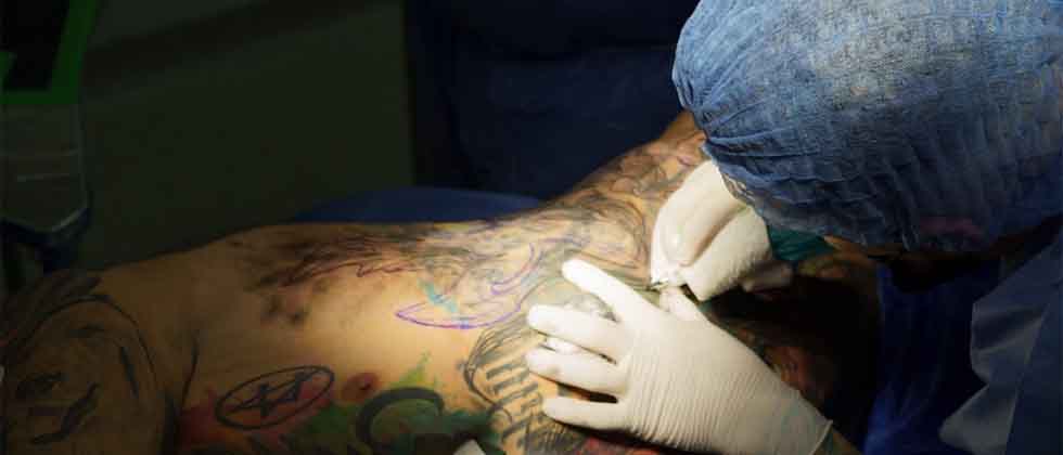Muere influencer al recibir anestesia general durante un tatuaje en la espalda
