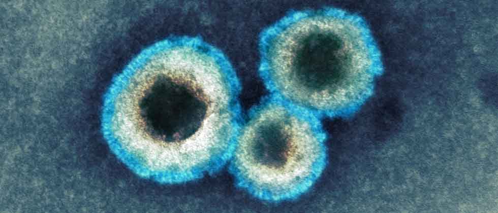 India confirma primeros casos de metapneumovirus humano (HMPV)