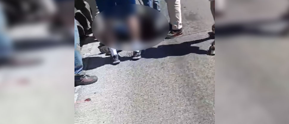 Niño de 10 años es atropellado por motociclista en Alameda Juan Pablo II