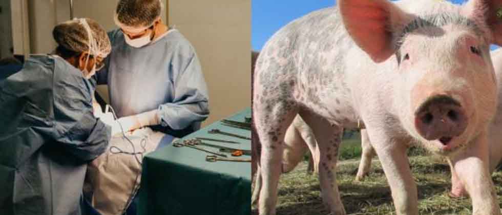 Logran trasplantar con éxito un riñón de cerdo a un humano