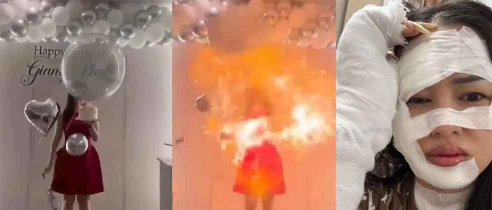 VIDEO: Explosión de globos en fiesta de cumpleaños deja a mujer con quemaduras graves