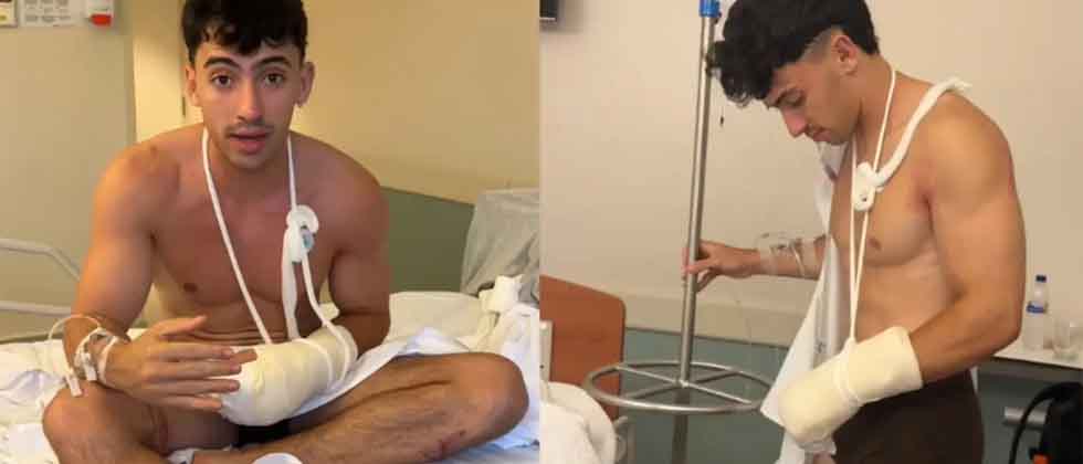 Famoso influencer pierde dos dedos tras sufrir un accidente