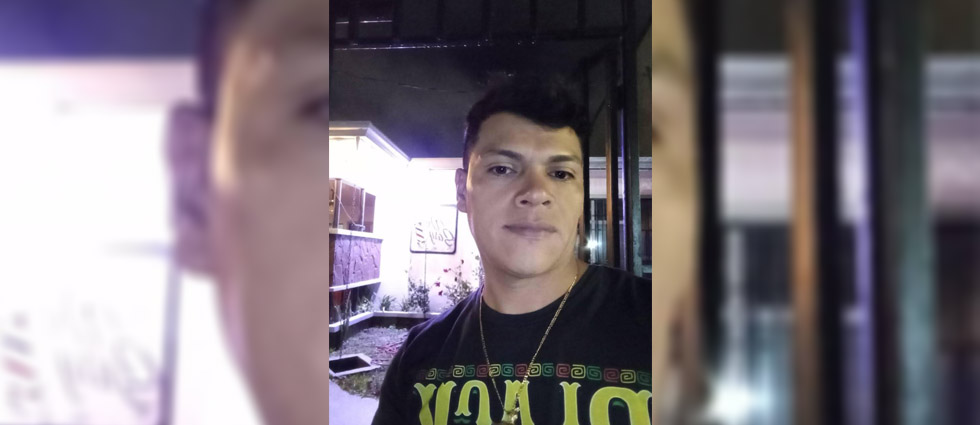 Buscan a hombre tras quemar con un químico el rostro y cuerpo de su expareja en Costa Rica