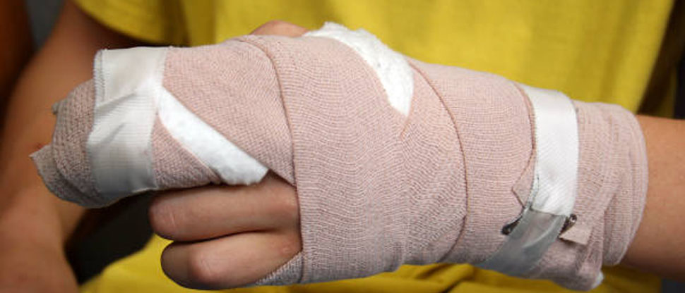 Castigo brutal: desalmada madre venezolana le quema la mano a su hija de 7 años por tomar su celular