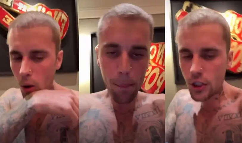 Justin Bieber preocupa a sus fans tras aparecer con deteriorado aspecto físico