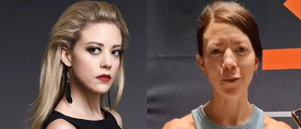 Actriz de “El Señor de los Cielos” preocupa a sus fans por su lamentable apariencia