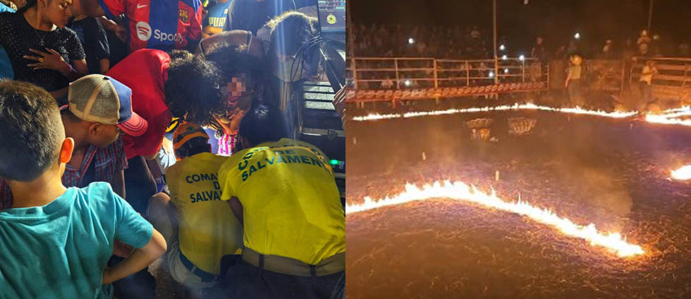 Niño sufre quemaduras por pólvora durante jaripeo en Acajutla