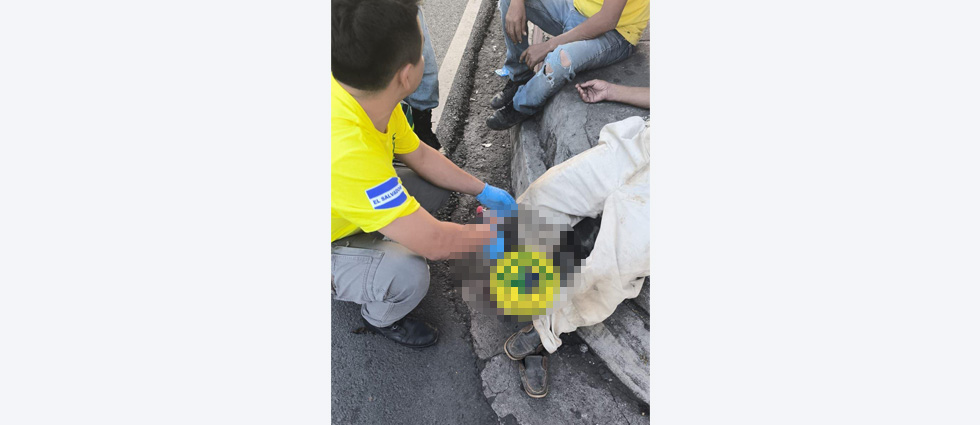 Peatón sufre fractura en el pie luego que vehículo le pasó una llanta encima