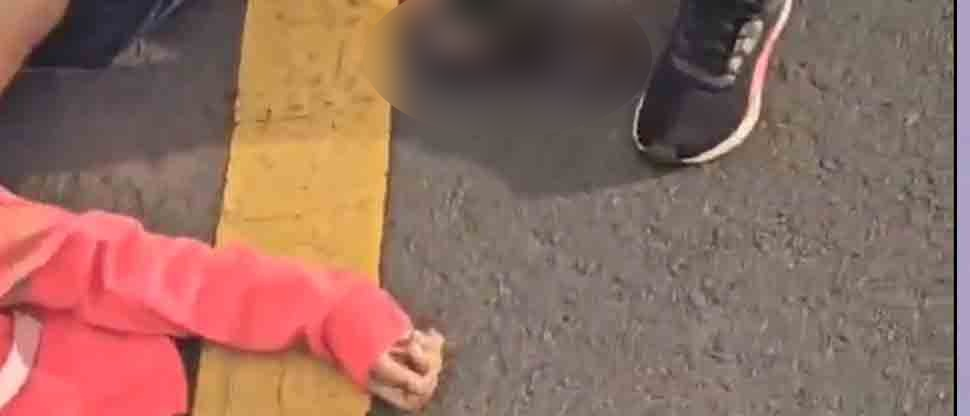Niña atropellada cerca de la frontera Las Chinamas continúa en estado de salud delicado