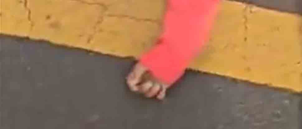 Brindan apoyo a niña atropellada de Ahuachapán a través del FONAT