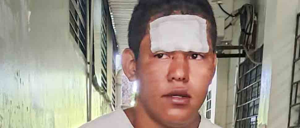 Arrestan a borracho que casi le amputa las manos a su hermana tras atacarla con un corvo