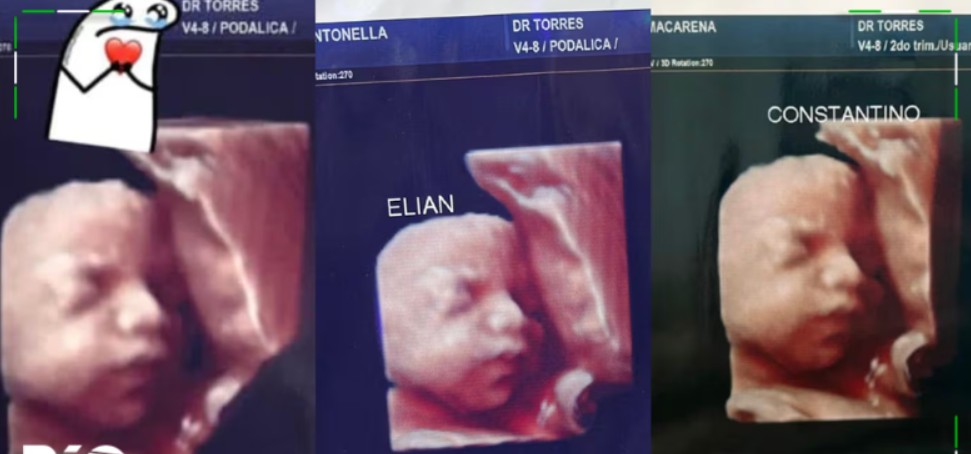 «La misma imagen»: Clínica entregaba las mismas ecografías 5D a mujeres embarazadas