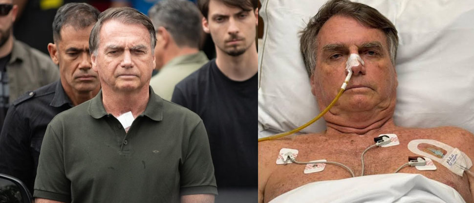 Brasil: expresidente Jair Bolsonaro es diagnosticado con cáncer de piel