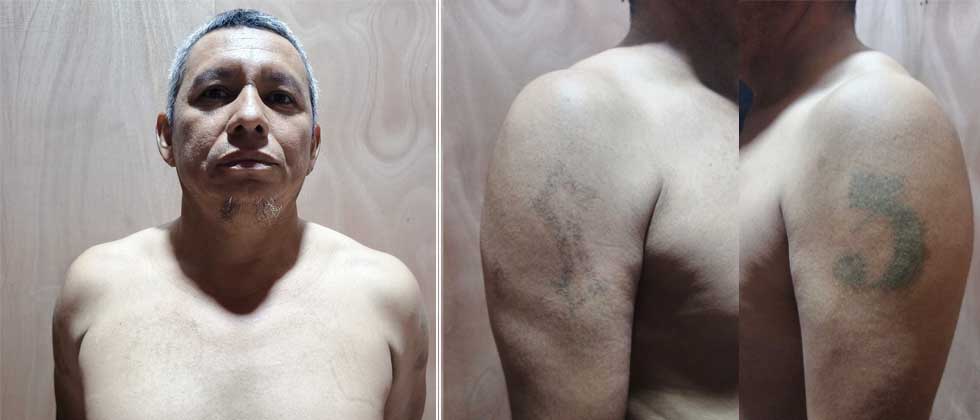Capturan a veterano pandillero que intentó borrar sus tatuajes alusivos a la MS