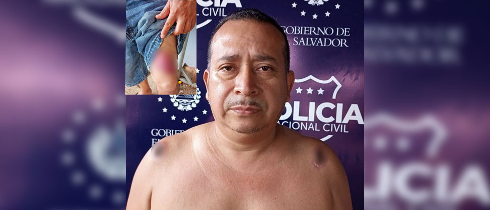 Cae pandillero que hasta se quemó sus tatuajes por miedo a ser capturado