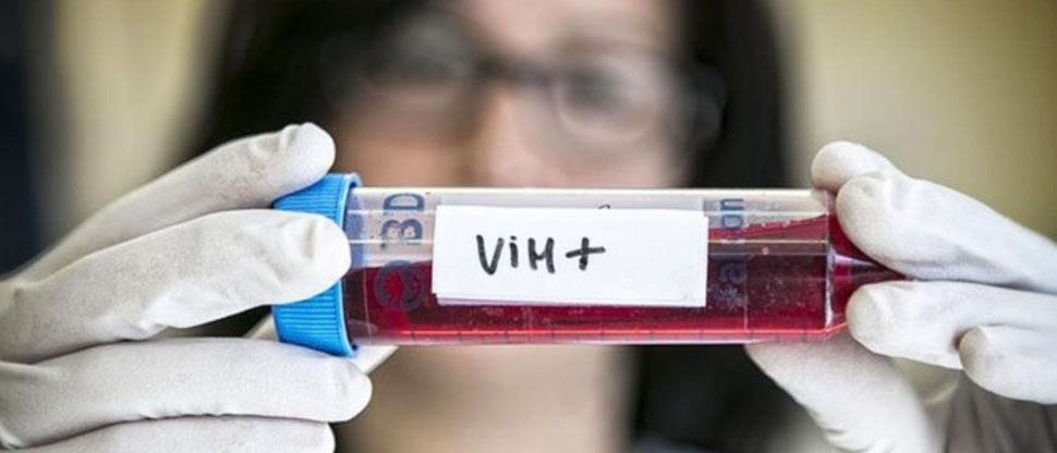 Investigadores chinos inventan nueva terapia para curar el VIH