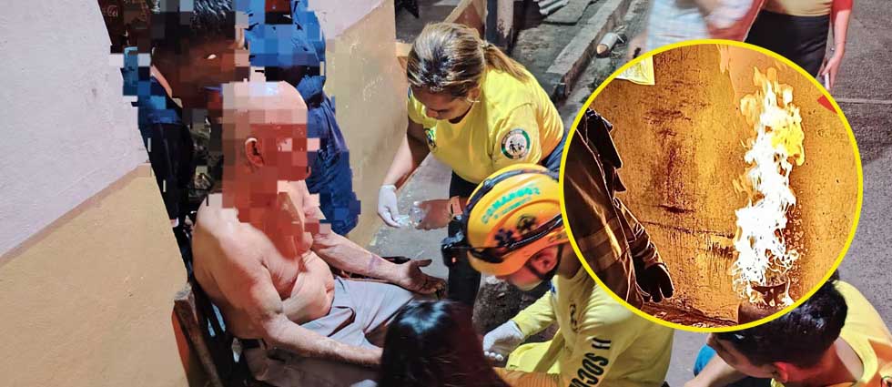 Adulto mayor sufre lesión al encender su cocina: «El cilindro de gas se incendió»