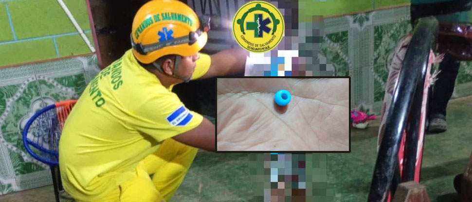 Auxilian a niño que se introdujo a su nariz un objeto para decorar pulseras