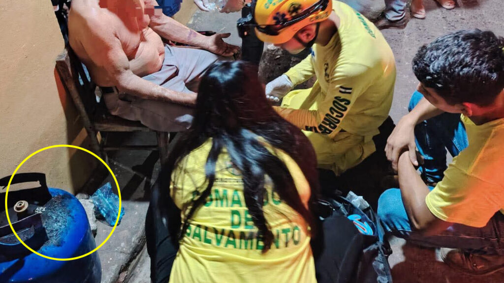 Hombre sufre quemaduras tras fuga de gas en su cocina